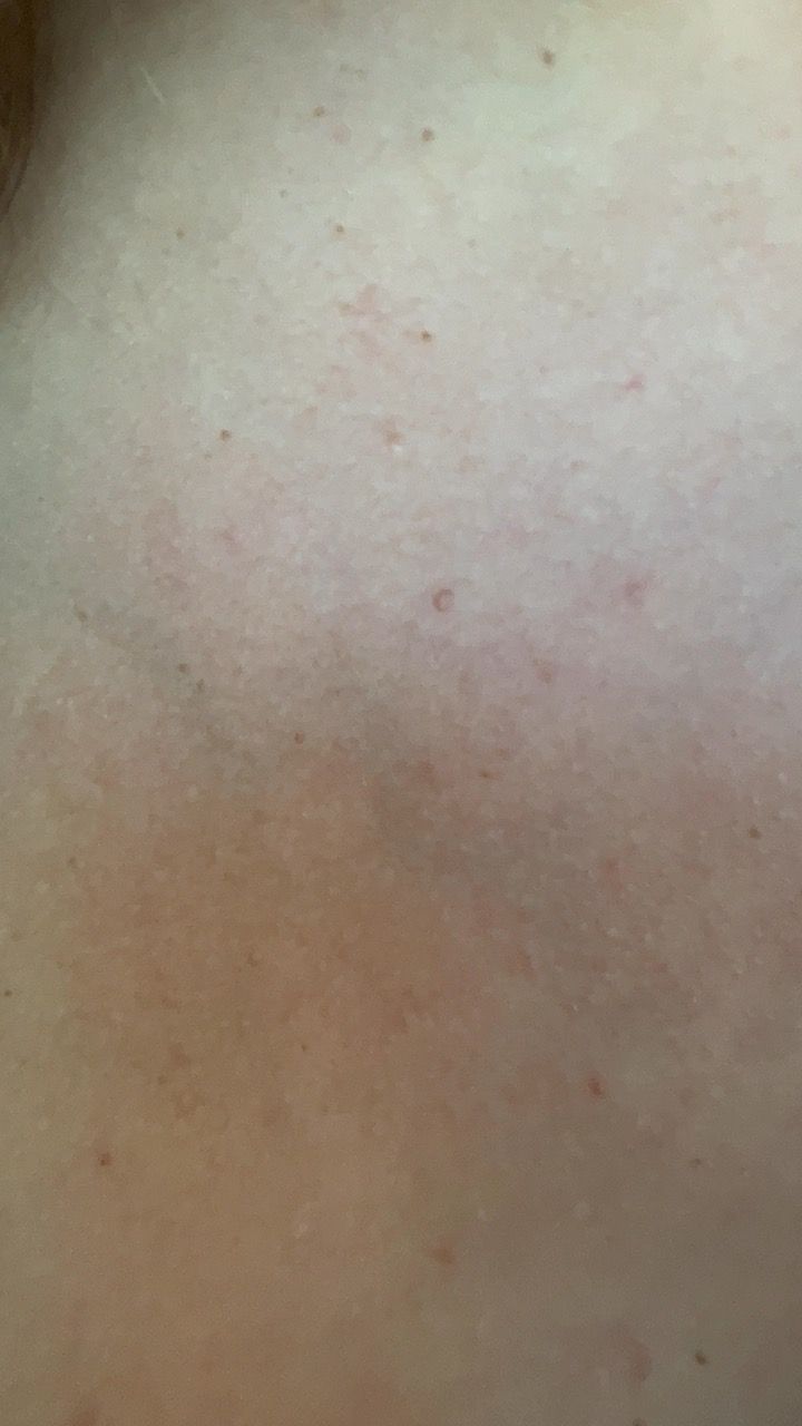 Foto erotica 1971167